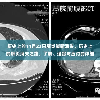 历史上的肺炎消失之路，全面追踪与应对指南（初学者与进阶用户适用）