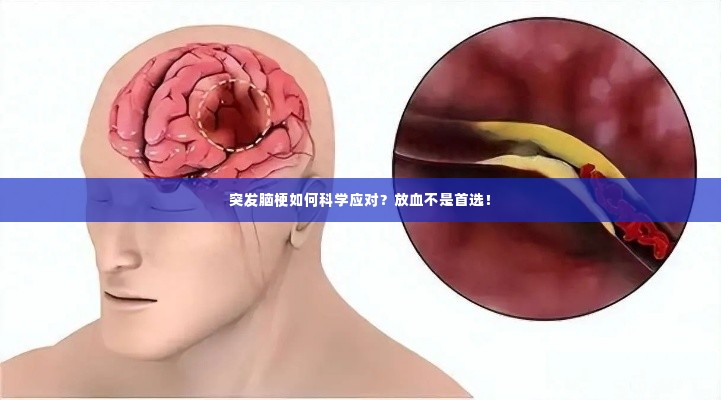 突发脑梗如何科学应对？放血不是首选！