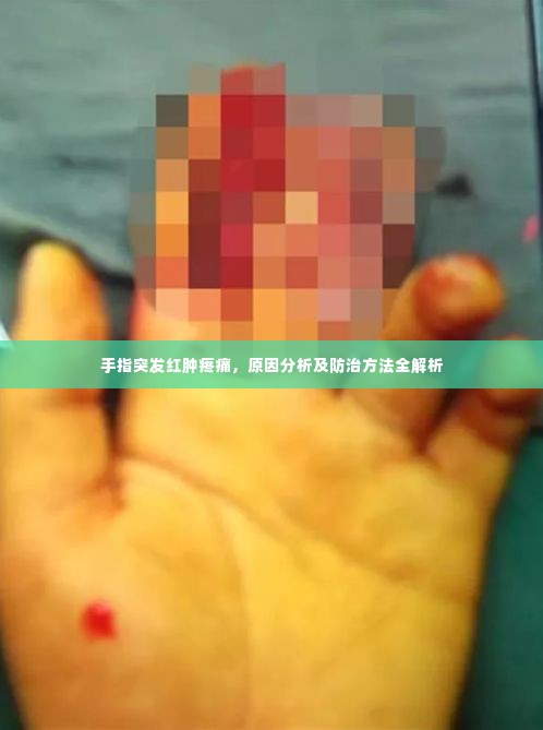 手指突发红肿疼痛，原因分析及防治方法全解析